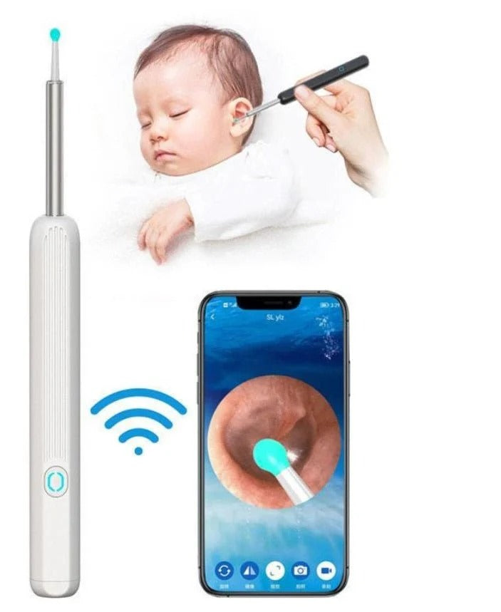 Smart Visual Ear Wax Removal Kit – Wireless HD Ear Cleaning Camera with LED
