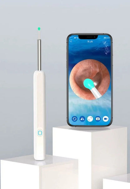 Smart Visual Ear Wax Removal Kit – Wireless HD Ear Cleaning Camera with LED